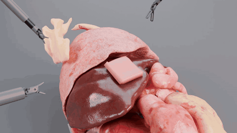 Surgical Simulation
