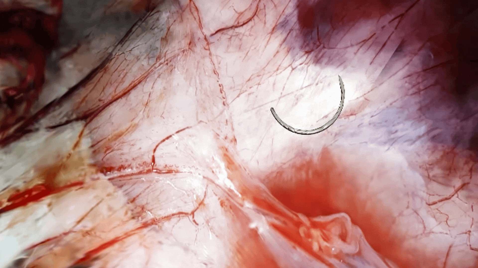 Surgical Simulation