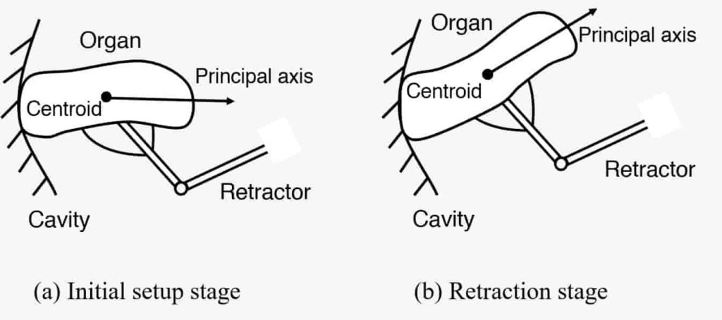 Automatic Organ Retraction with Deformation Control – BMT Lab, MAE, CUHK